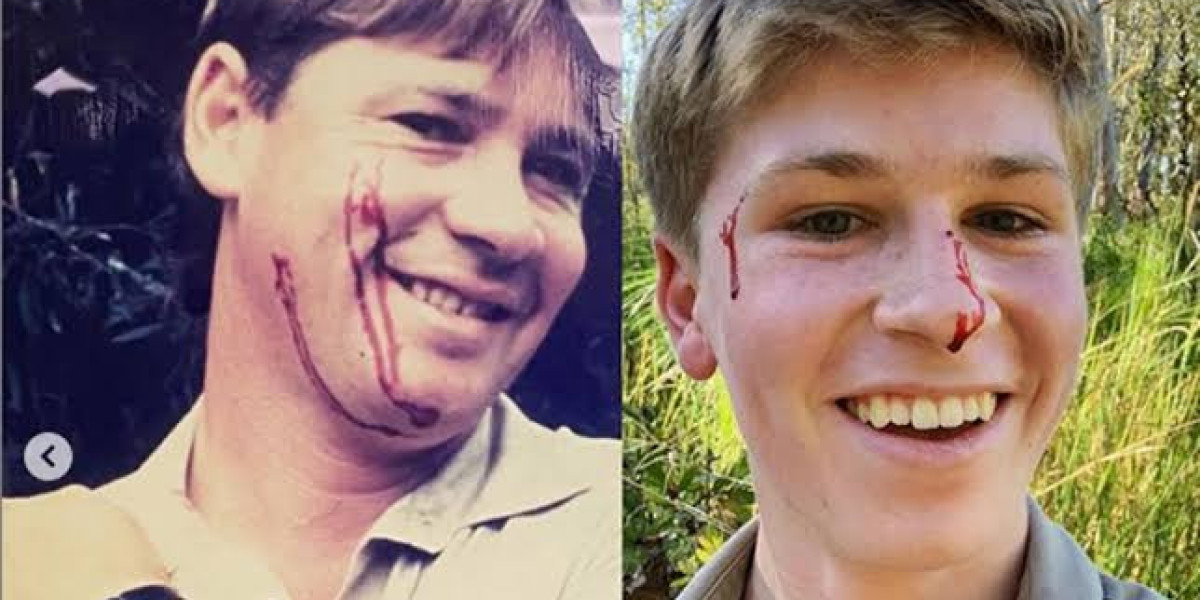 Robert Irwin - Following in His Father's Footsteps with a Modern Flair | News